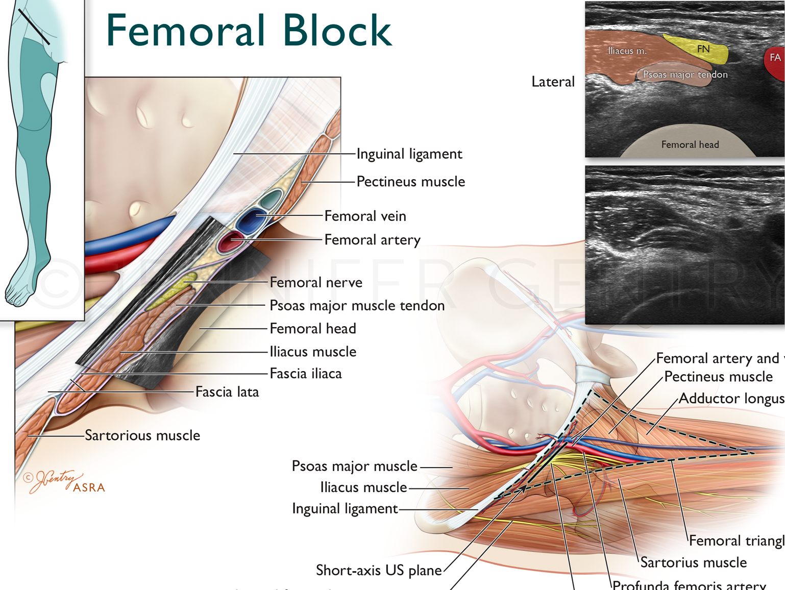femoral nerve anatomy